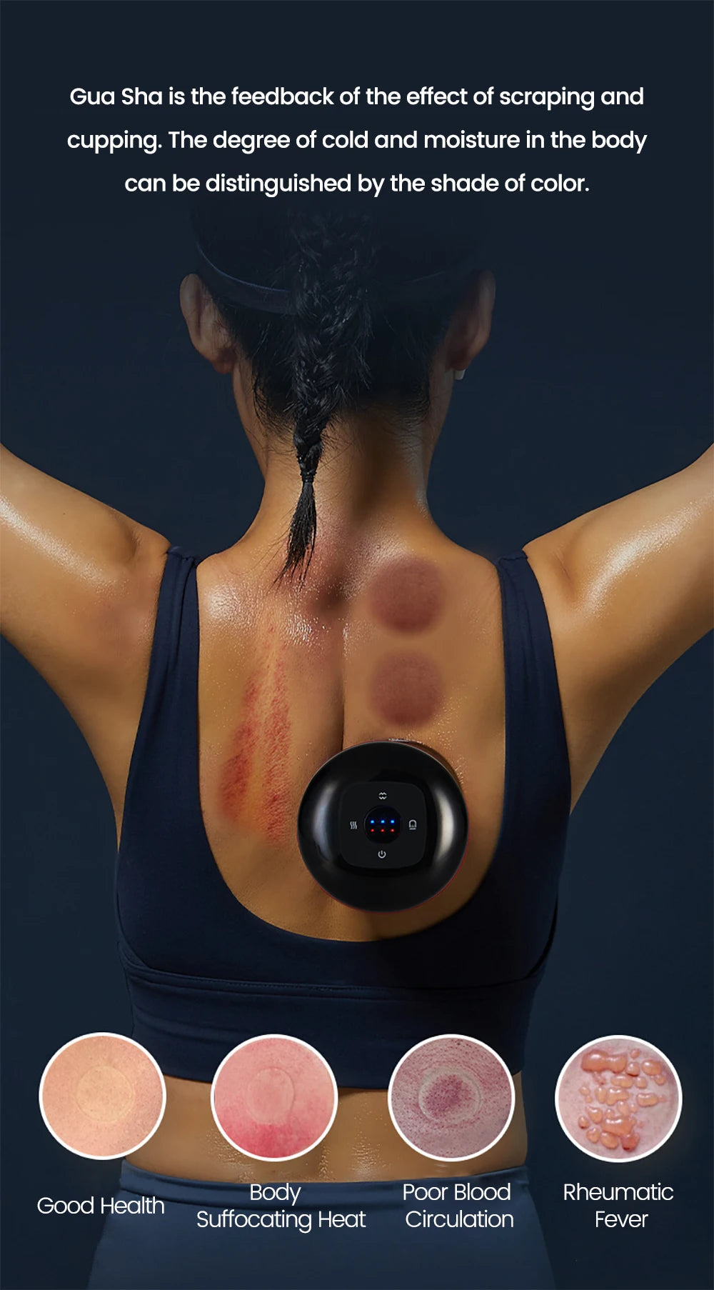 ELECTRIC VACUUM CUPPING MASSAGE