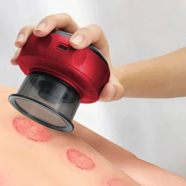 ELECTRIC VACUUM CUPPING MASSAGE